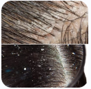 Raiz capilar mais fraca