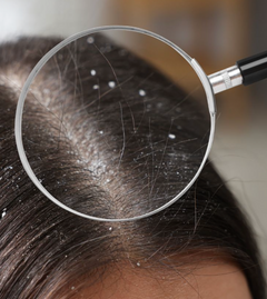 Raiz capilar mais fraca